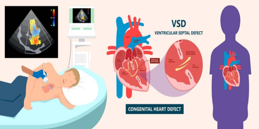 VSD FULL FORM