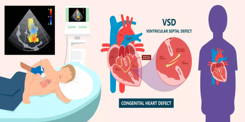 pm vsd full form in medical
