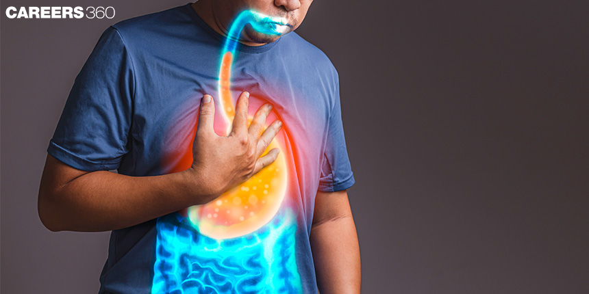 Understand What Causes Acid Reflux, And How You Can Curb It