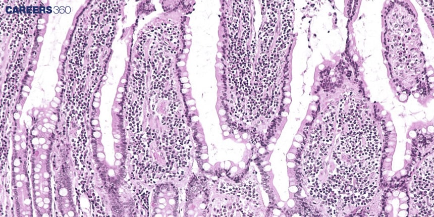 Intestinal Glands: Definition, Function, Diagram, Examples