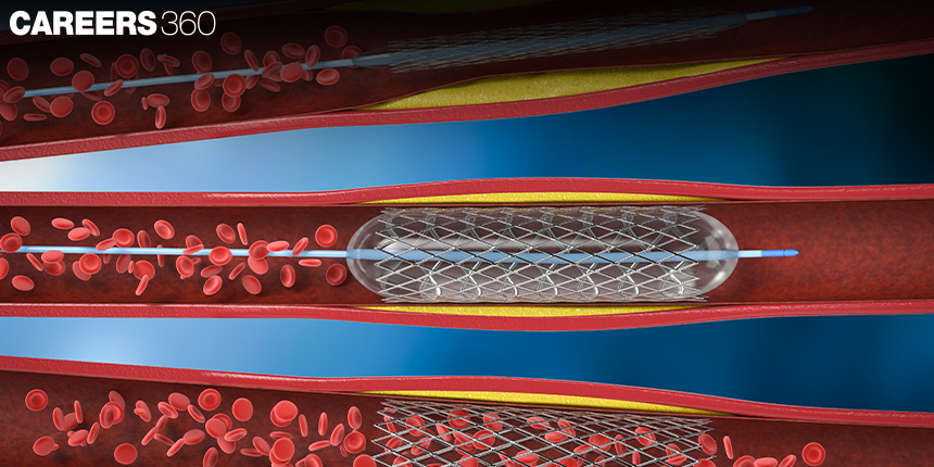 Plasma Membrane: Definition, Types, Examples, Diagram, Questions