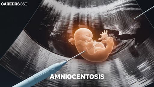 Amniocentesis - Accuracy, Benefits & more Details