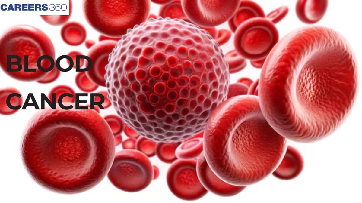 Blood Cancer: Types, Symptoms, Treatment & Survival Rate, Lymphoma, Leukemia