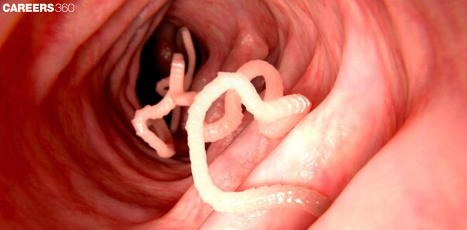 a tapeworm