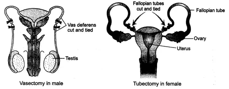 surgical methods