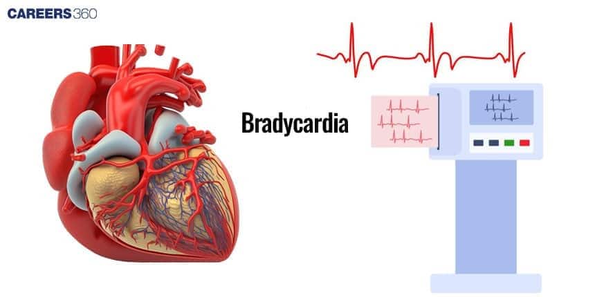 Illustration showing the human heart and an ECG monitor displaying a slow heart rate pattern, representing bradycardia — a condition where the heart beats slower than normal.