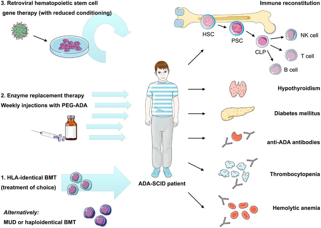 gene therapy