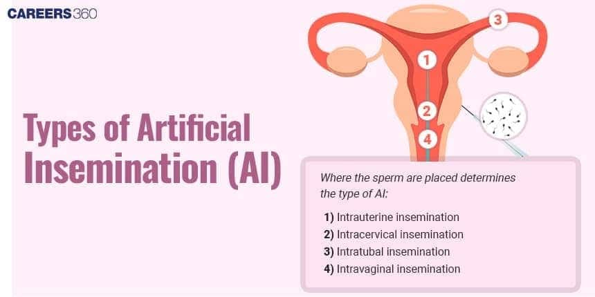 Types of Artificial Insemination in Biology